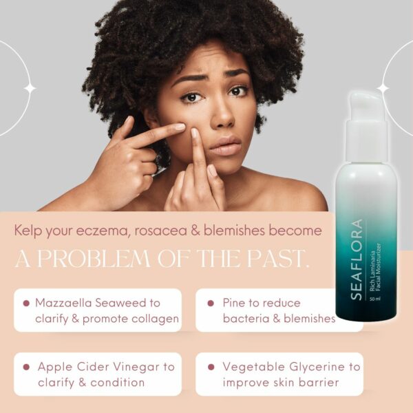 detoxifying acne moisturizer
